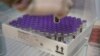В Україну прибула закуплена держкоштом партія вакцини від Pfizer-BioNTech
