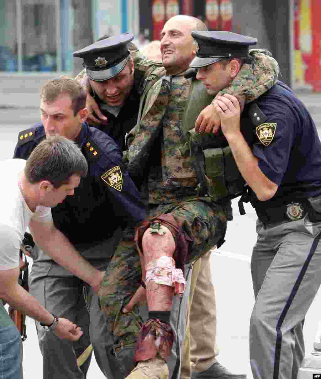Полицейские оказывают помощь грузинскому солдату, раненому в бою с южноосетинскими сепаратистами в Гори. 8 августа 2008 года. 